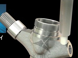 喷油器加工后残留小毛刺，锐必克陶瓷研磨刷一刷搞定
